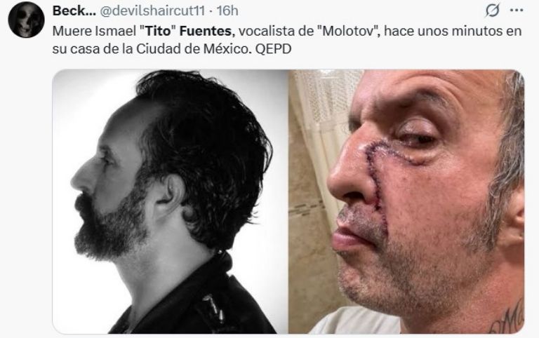 tito fuentes molotov estado de salud enfermedad murio