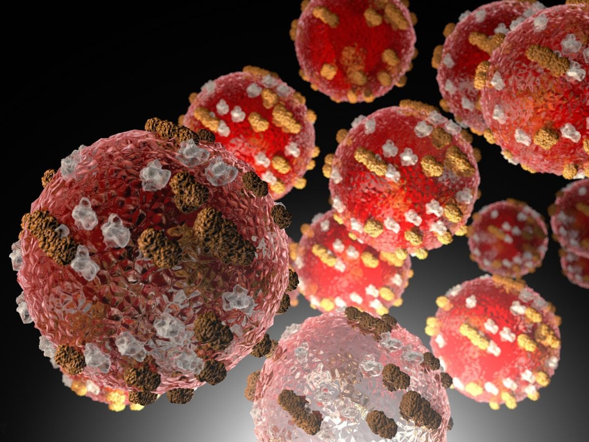 El virus del sarampión puede hacerte olvidar cómo defenderte Foto Canva 