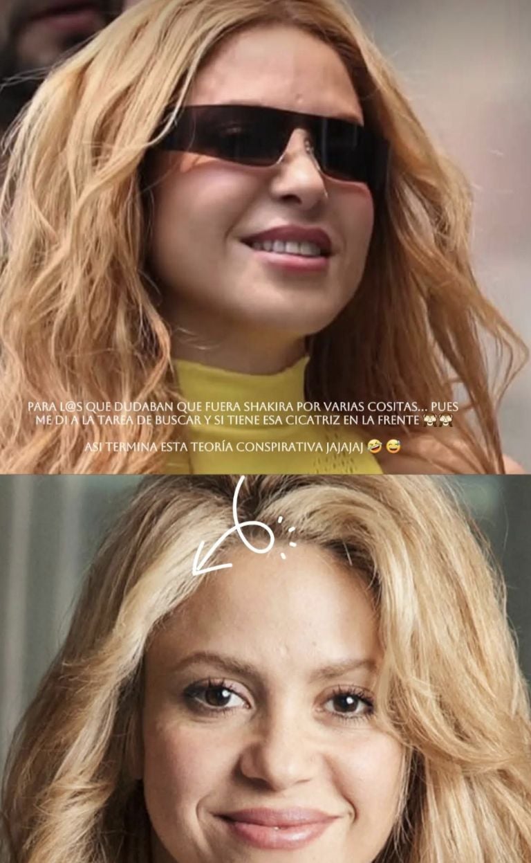 Primer plano de Shakira mostrando su cicatriz facial
