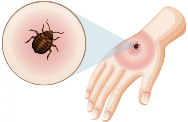 Prevención contra garrapatas