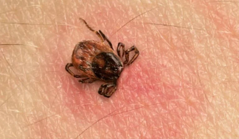 Imagen informativa sobre el virus Powassan